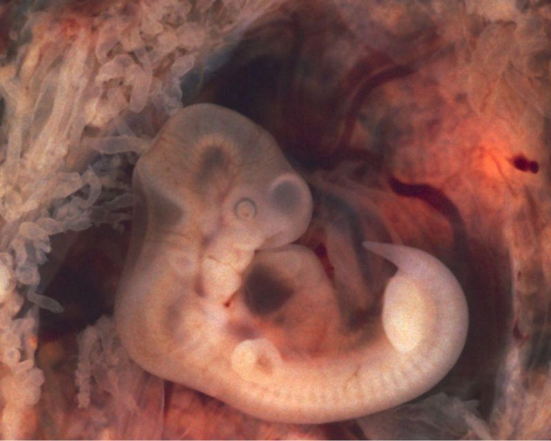 Rozwój zarodkowy człowieka - zarodek 