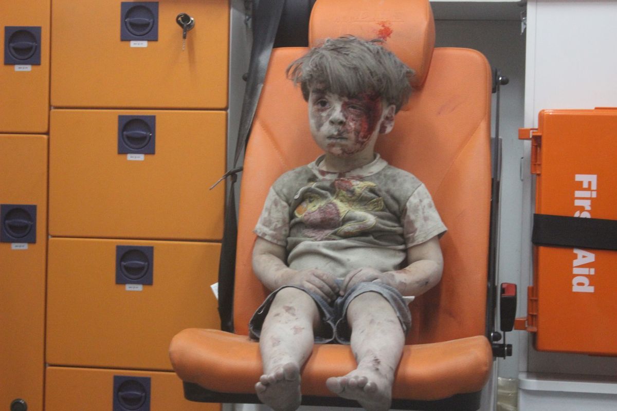 Zdjęcie tego dziecka obiegło cały świat. Wojna odbiera im życie