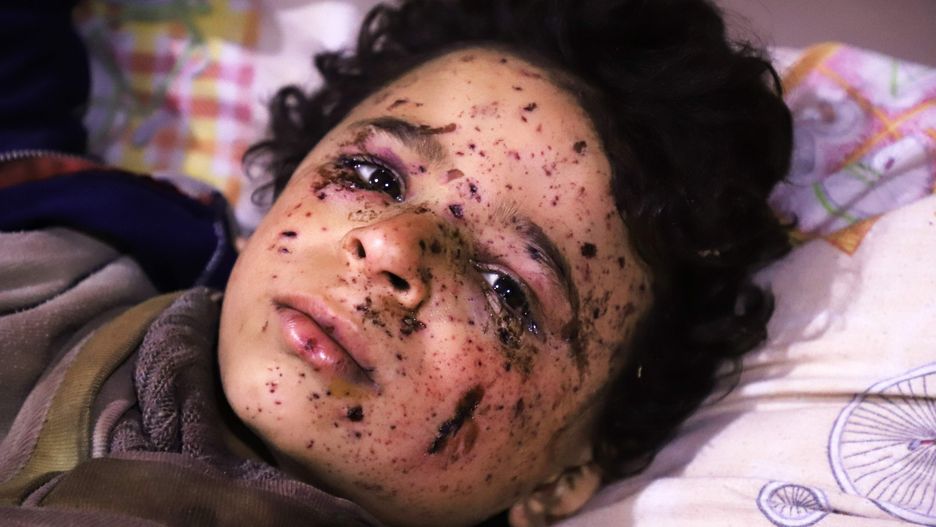 Omar stracił kilku członków rodziny podczas ataku samolotów na Wschodnią Ghoutę