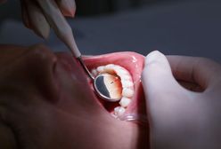 Dentysta miał wyłudzić pół miliona złotych. Ponad 900 osób zeznało, że nie wykonał im zabiegów