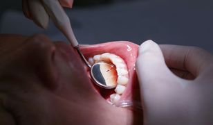 Dentysta miał wyłudzić pół miliona złotych. Ponad 900 osób zeznało, że nie wykonał im zabiegów