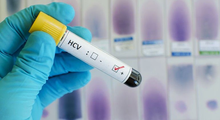 HCV - jestem świadom. Kampania przeciw wirusowi powodującemu WZW typu C