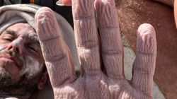 Chciał pobić rekord. Pokazał, jak wygląda teraz jego skóra