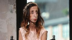 Kim jest Lizzie Velásquez? Mówią o niej "najbrzydsza kobieta świata"