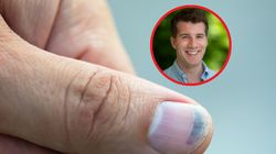 Chore serce zobaczysz na paznokciach. Lekarz ostrzega przed mało znanym objawem