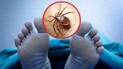 Zmarł po ugryzieniu kleszcza. "Nowa choroba, która występuje w całej Europie Zachodniej"