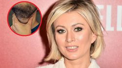 Ojciec dziennikarki miał raka. Powiedziała, jaki był pierwszy objaw