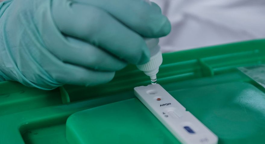 Ministerstwo Zdrowia zezwoliło na wykonywanie komercyjnych testów na koronawirusa 