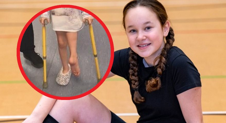 Odważna 12-letnia dziewczyna, której lekarze przyszyli jej nogę do tyłu, po zdiagnozowaniu raka kości zaczyna biegać z nową protezą
