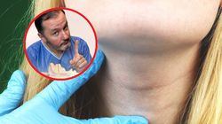 Laryngolog alarmuje. Jeśli trwają dłużej niż trzy tygodnie, to może być rak