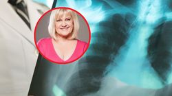 Marzena Kipiel-Sztuka miała POChP. Główny objaw choroby pojawia się po przebudzeniu