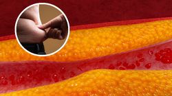 Dotyka ponad 20 milionów Polaków. "Panuje idiotyczne przekonanie, że lekarze działają na szkodę pacjentów"