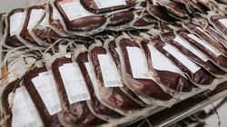 Grupa krwi, która zwiększa ryzyko raka żołądka o kilkadziesiąt procent. "Naukowo udowodnione"