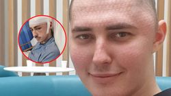 Lekarz zalecił leki przeciwbólowe. 23-latek ma guza mózgu wielkości grejpfruta