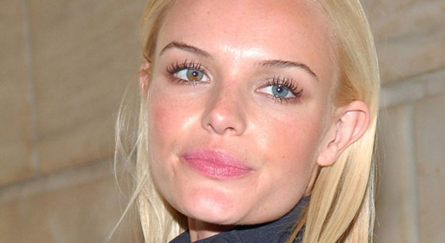 Kate Bosworth ma dwukolorowe tęczówki