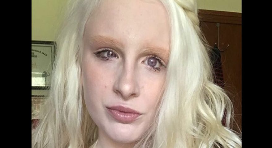 Jest albinoską. Internet oszalał na jej punkcie. "Wygląda jak anioł"