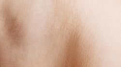 Guzek pod pachą - charakterystyka, przyczyny, diagnostyka