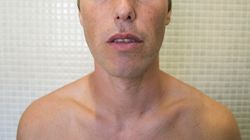 Zauważył to na języku miesiąc przed śmiercią. To był objaw raka jelita grubego