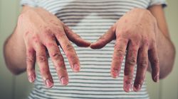 5 chorób, które są często źle diagnozowane