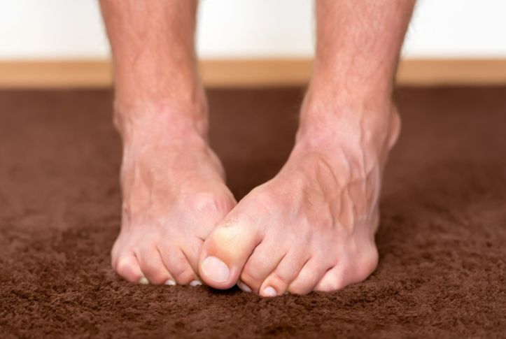6 powodów, przez które swędzą cię stopy. Poznaj je wszystkie