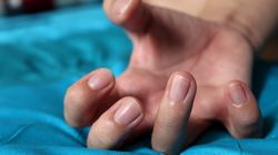 Tak rozpoznasz krwiaka mózgu. Objaw widać w oczach, ale warto przyjrzeć się też dłoniom