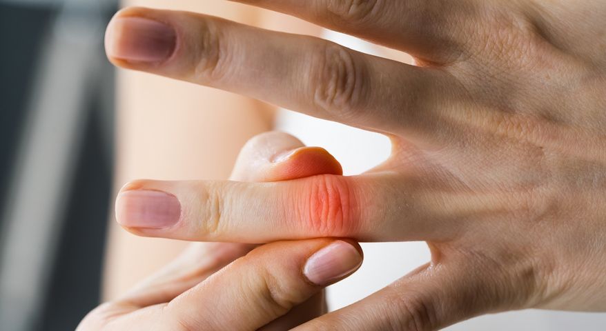 Drętwienie palców – przyczyny, leczenie