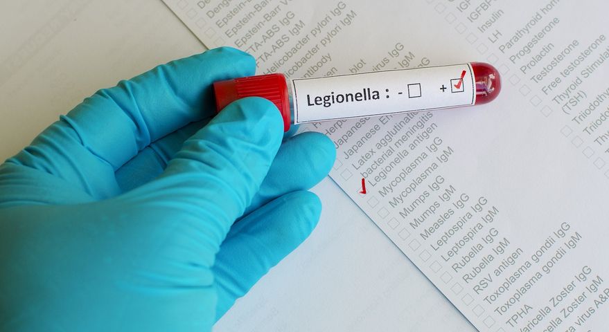 Legionella w Polsce. Nie ma nowych zgonów