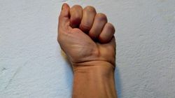 Prosty test może uratować ci życie. Powie, czy masz zablokowane tętnice