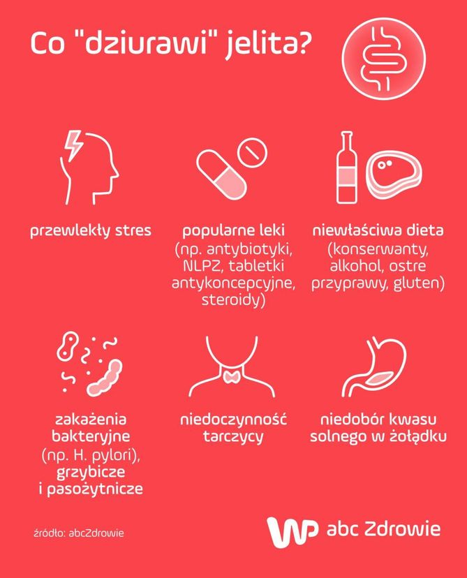 https://v.wpimg.pl/eXkwLmpwSjkKFTpeXwxHLElNbgQZVUl6HlV2T19BU2ETR2MdHwUROQdaLQ8TDQEqBAAlCF4AFTsPGWIdHFgMNQoQKS4RFA09REV8X0NYVWBER3hCExhIPBEeOR8RAAx1BBwTVUhAXXZGD3wUQA8daBIOfEMaBwJ6Fg