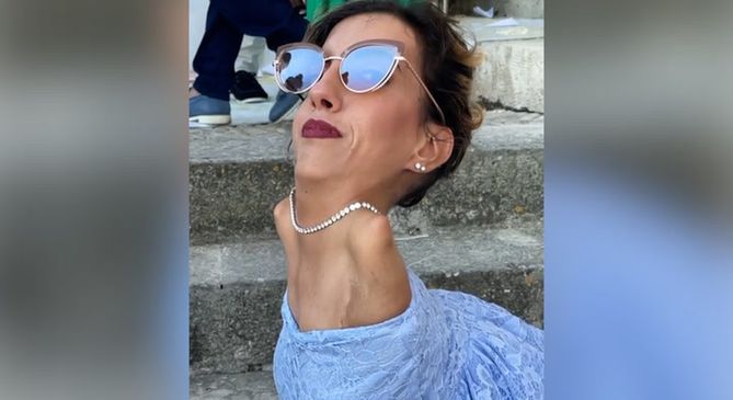 Nadia urodziła się bez rąk, ale to nie przeszkodziło jej, by żyć pełnią życia.
