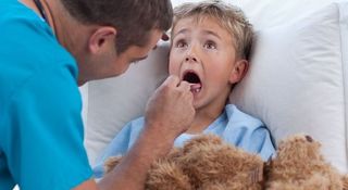 Zapalenie migdałków