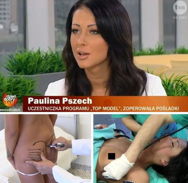 "Dzień dobry TVN": Uczestniczka "Top Model" po wszczepieniu implantów!