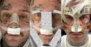 Stifler przeszedł serię operacji plastycznych. Tak wyglądał chwilę po. A jak teraz? Zmianę widać gołym okiem