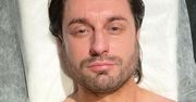 Rafał Grabias co do joty zrelacjonował, jak poprawia sobie twarz. Nas boli na sam widok! Wcześniej powiększył usta