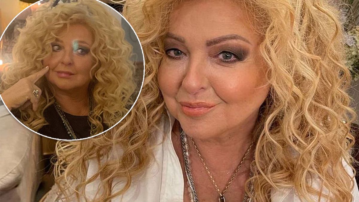 Magda Gessler o operacjach plastycznych