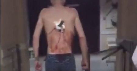 Pacjent wyszedł ze szpitala z nożem w plecach. Powiedział, że musi zapalić