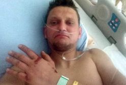 Polak, który pobił rekord Guinnessa poważnie ranny w wypadku na drodze w Kanadzie