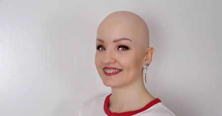 "Całe życie czułam, że jestem naga". Fotomodelka opowiada o życiu z łysieniem plackowatym