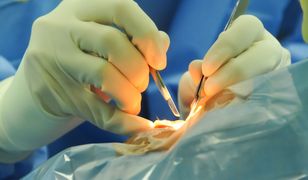 NFZ ma dość. Szykuje się na tych, co uciekają leczyć się za granicę