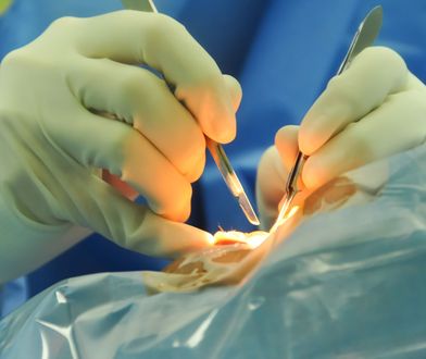 Operacja zaćmy w Czechach. Ministerstwo mówi o końcu turystyki medycznej. Kliniki pokazują dane