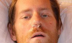 Policja już wie, kim jest człowiek znaleziony w Tatrach