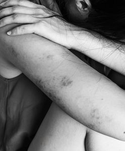 Polewali ją wrzątkiem i przypalali papierosami. Współlokatorzy odpowiedzą za znęcanie