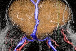 Operacja potrwa dłużej