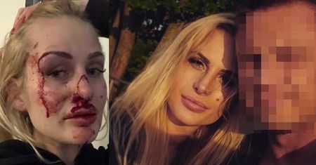 Pobita Katarzyna Dziedzic w Polsacie:"Zobaczyłam w jego oczach szał"