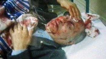 Jedna z ofiar eksplozji