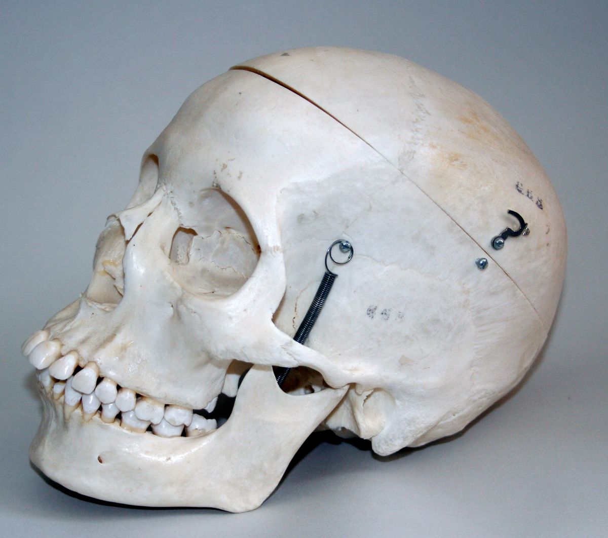 Dwie czaszki ponad 70 lat leżały w szafie niemieckiego lekarza. Eksperci ustalą do kogo należały?