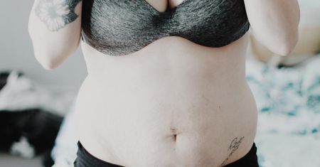 Obwisłe i gęsto pokryte rozstępami. Odważne matki pokazały swoje brzuchy po ciąży