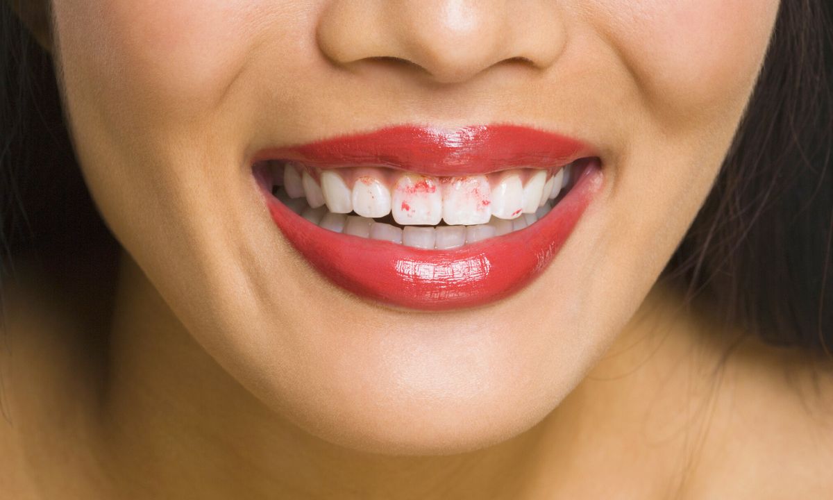 szminka na zębach, fot. Getty Images