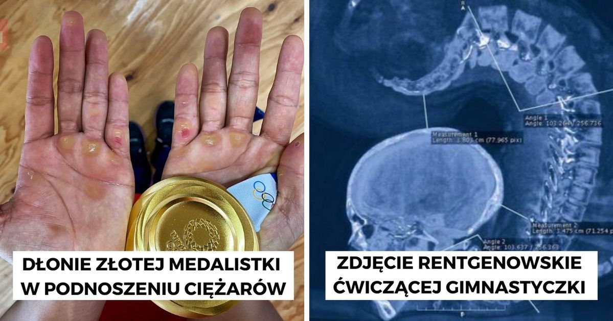 17 zdjęć olimpijczyków, które dają do myślenia o ich poświęceniu i woli walki