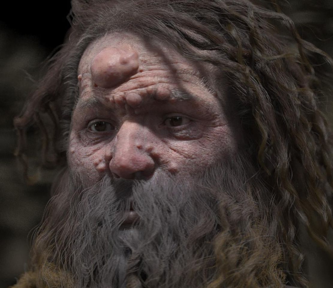 Zrekonstruowali twarz prehistorycznego człowieka. Cierpiał na rzadką chorobę